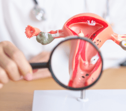 endometrióza